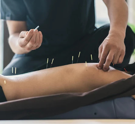 Acupuntura Yintang is a highly recommended acupuncturist in Guadalajara