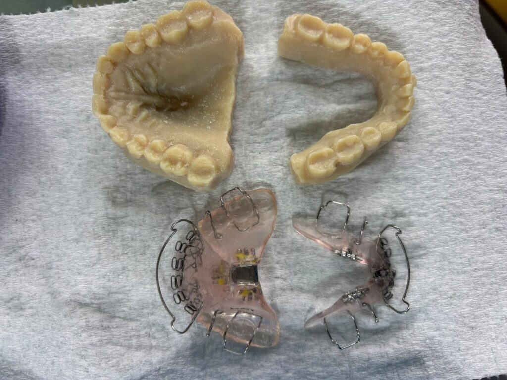Upper and lower custom oral appliances beside dental models at BeRaediant Dental Med Spa. 