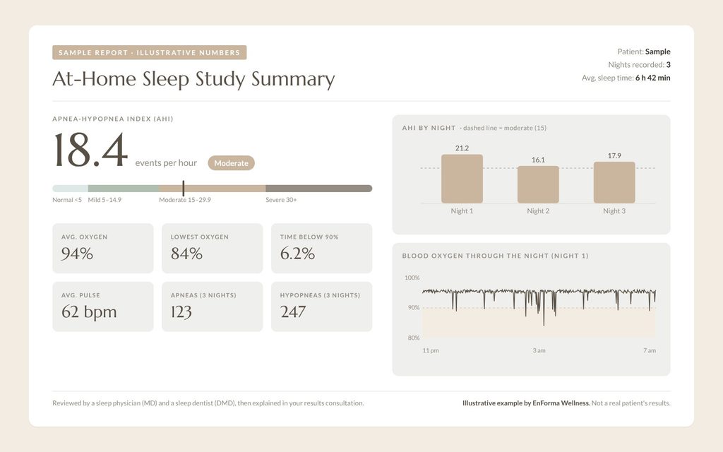 At-home sleep study sample report